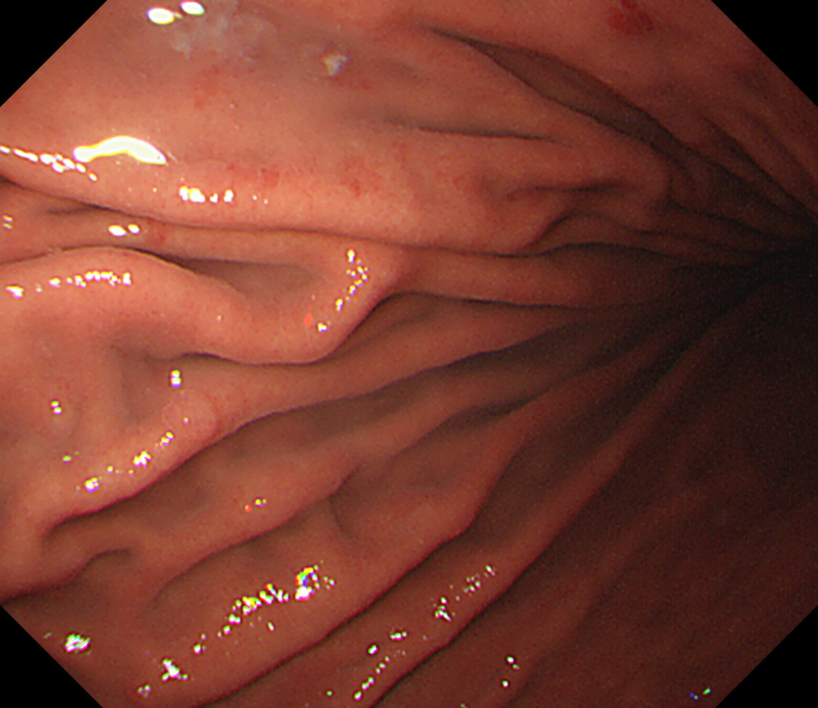 �̉������